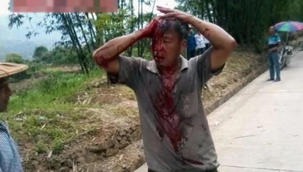 福州网友控诉村民被两三千名武装人员暴力殴打(组图)