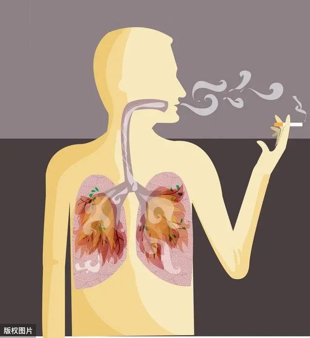 有人一直吸煙 肺乾乾淨淨 有人從不吸煙 卻查出肺癌？真相來啦