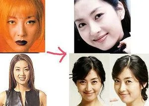 韩国首批整容者遭遇后遗症 美女变加菲猫(组图)