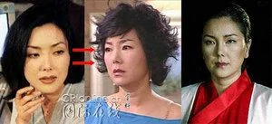 韓國首批整容者遭遇後遺症 美女變加菲貓(組圖)