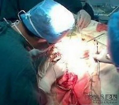 医生拍下同事做手术时打游戏 网友称拍照更不对 