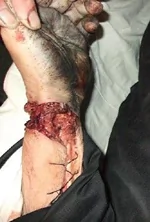 圖片：死者手腕的殘酷刀割痕跡，難以想像是自殺造成。（家屬授權發表）