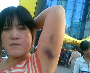 圖片：無錫訪民陶國芬在北京遭江蘇法警打傷。（權利運動/記者喬龍）