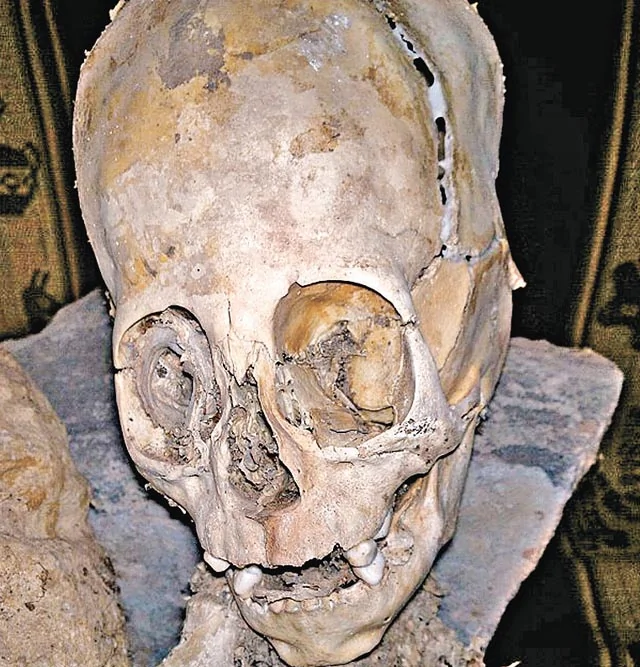秘魯私人博物館館長克里爾梅發現的這具&#20094;屍，經三名人類學家研究後斷定並非地球人，認為是外星人的遺骸。網際網路