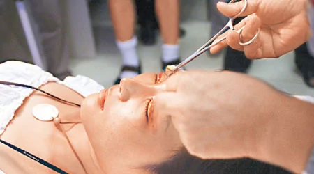 北京一名女士正接受割双眼皮手术。 （Getty Images图片）