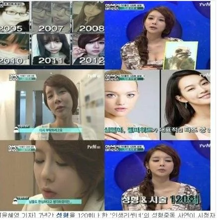 韓國女子7年整容120次 嘆割完雙眼皮待遇就不同(圖)