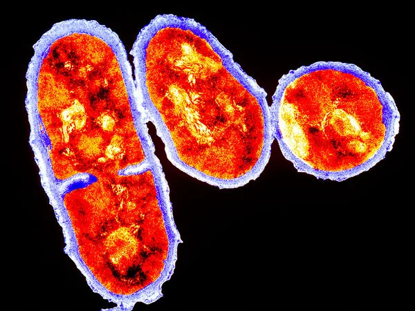 揭秘人体中藏污纳垢的部位：内脏滋生3万种细菌(组图)