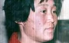 9/18/2002發表.山東安丘大法弟子趙鳳英面部被不法之徒用煙頭燒傷的照片