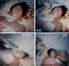 8/3/2003發表.妹被折磨癱瘓　姐遭刑訊致殘──河北省610歹徒暴行（圖）
