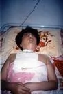 8/3/2003发表.妹被折磨瘫痪　姐遭刑讯致残──河北省610歹徒暴行（图）
