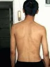 9/10/2003發表.圖片證據：我被惡警酷刑折磨後留下的疤痕
