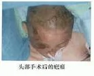 1/22/2002发表.图片：黑龙江省大法弟子迟春霞被残酷迫害
