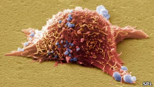皮膚癌細胞