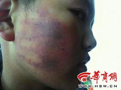 教师让50名学生轮流扇没写作业男孩耳光(图)