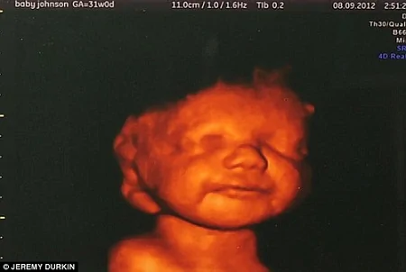 孕婦產檢看到腹中殘疾胎兒微笑決意不墮胎(組圖)