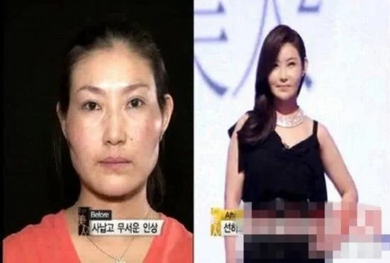 韓國整容節目真人秀:醜女變美人讓人震驚(組圖)