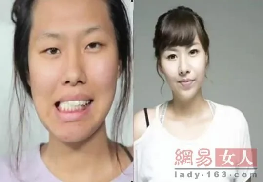 韓國整容節目真人秀:醜女變美人讓人震驚(組圖)