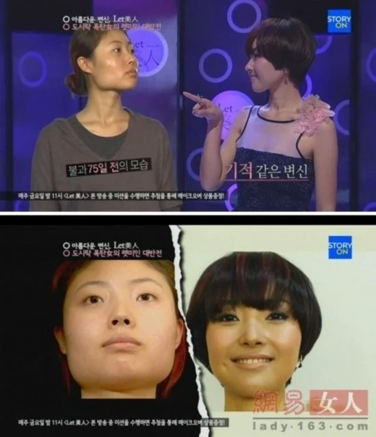 韩国整容节目真人秀:丑女变美人让人震惊(组图)