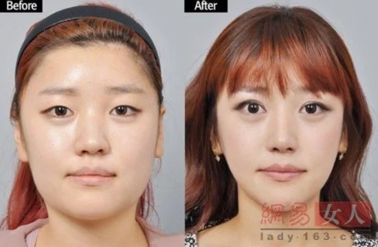 韓國整容節目真人騷:醜女變美人讓人震驚(組圖)