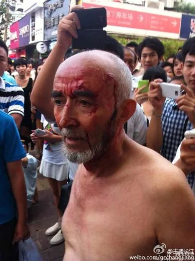 廣州城管打爆維族老人頭部遭百人圍堵