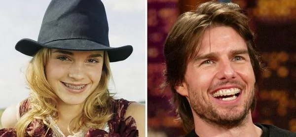 圖片來自：weasleyovi.blog.cz&forumshot.com。左圖：正在接受正畸治療的Emma Watson。右圖：正在進行正畸治療的Tom Cruise。