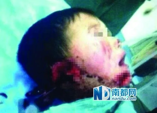 警方證實「幼童慘遭二媽割耳」一事。網絡圖片