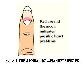 指甲出现这十种可怕现象 需要马上求医