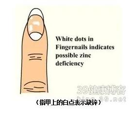指甲出现这十种可怕现象 需要马上求医