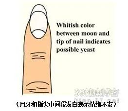 指甲出现这十种可怕现象 需要马上求医