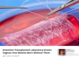 用患者細胞實驗室培養出陰道