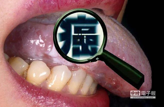 这十种人罹癌可能性偏高 你在其中吗!?