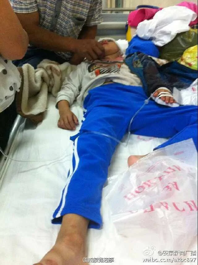 受伤的小学生在医院接受治疗。