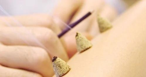 艾灸能治400多种病,值得一看