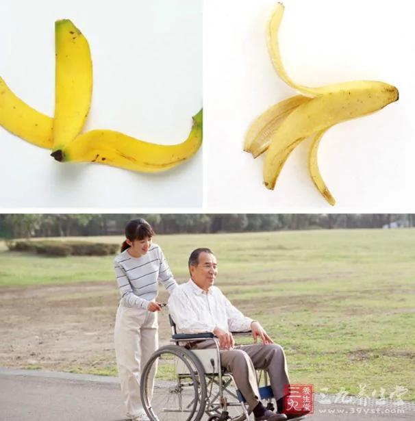香蕉皮作用大 可治疗9大疾病