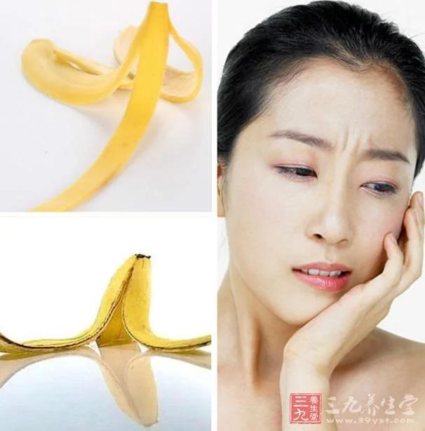 香蕉皮作用大 可治疗9大疾病