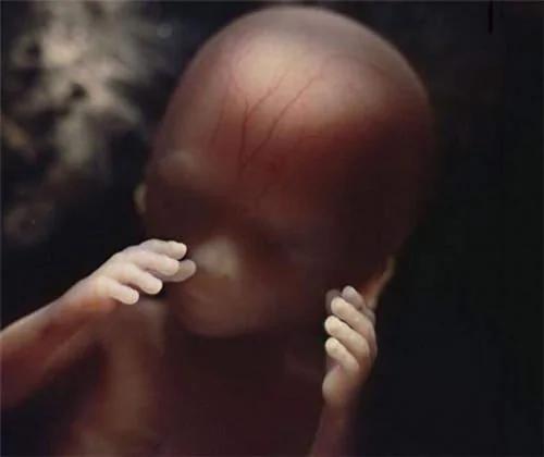 震撼:10年拍下女人身体里神奇的照片