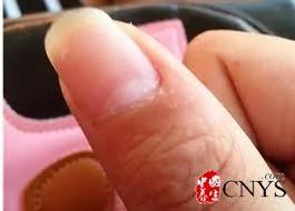 人体9个死角最容易被忽视 隐蔽的指甲缝细菌最多