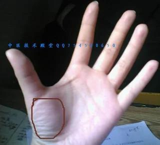 心臟不好的人 手掌有一個隨身攜帶的 救心丸