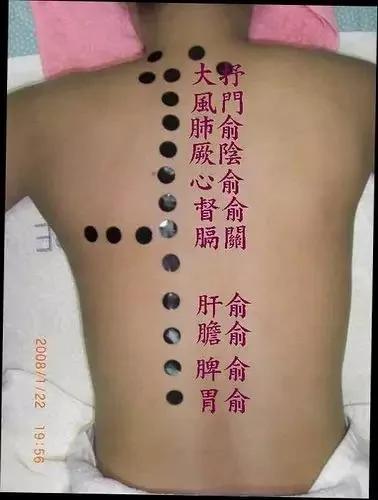 保养背部比保养脸更重要 不信你看