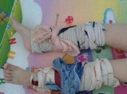 德国妈妈的湿毛巾绑腿退烧法,连我的台湾老妈都说超厉害