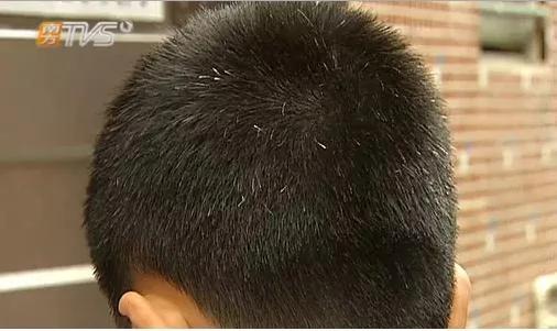 养肾就是养命 男女通用的补肾养发秘方