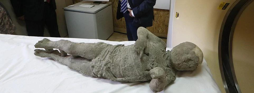 庞贝古城木乃伊接受CT扫描 死前表情惊恐