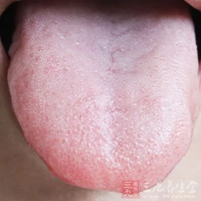 症狀一：舌苔有變化