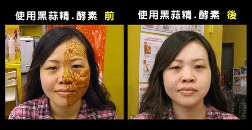 组图:又一个食材的奇迹!它能防癌抗癌,是防治三高的能手,黑蒜功能大揭秘!