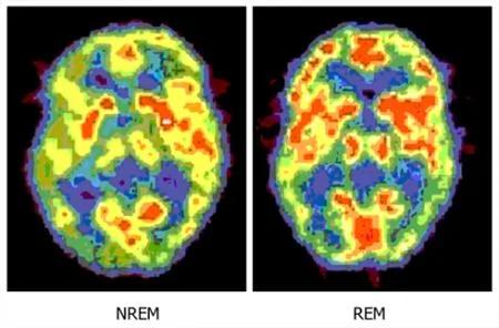 人类大脑少为人知的6个奇特事实