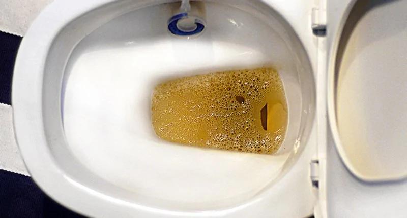 原来洗肾前会有这12种警讯 快看看吧!