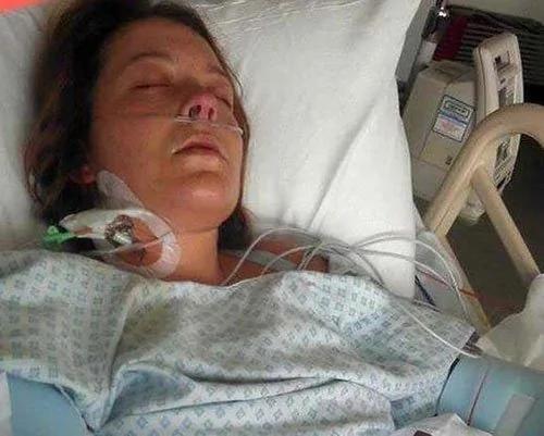 卫生棉超强吸力 差点让28岁女子丧命