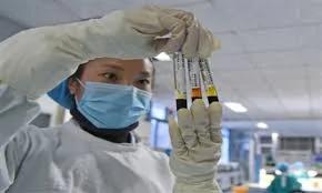 抽烟喝酒其实易患这种癌!大多数人都无视了!