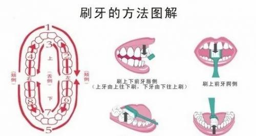 牙齿出现小黑点 千万别忽视它可怕的力量!