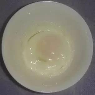 老中医神奇秘方:白糖蒸鸡蛋,一招搞定咳嗽!